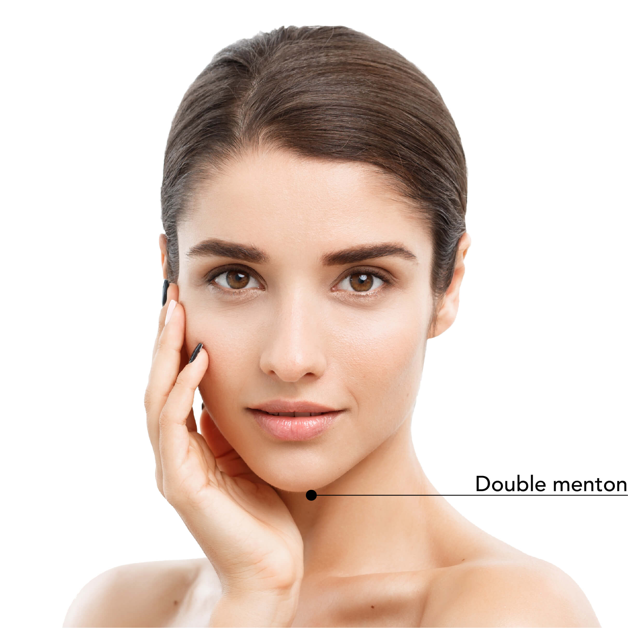 https://www.stlaurentme.com/wp-content/uploads/2024/05/St-Laurent-Medico-Esthetique_Belkyra_Zones_traitable_2.jpg