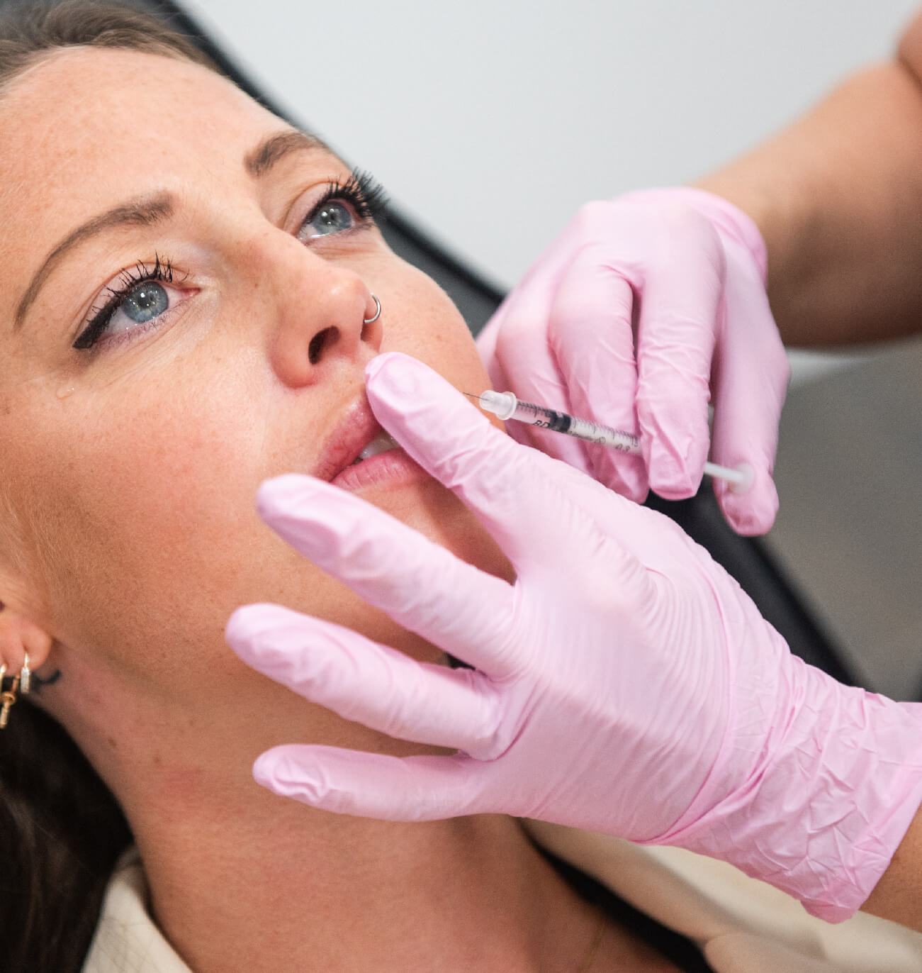 Injection d’acide hyaluronique pour repulper les lèvres dans un centre médico-esthétique. Patiente détendue, professionnel en gants roses réalise une technique d’injection précise pour améliorer le volume des lèvres et combler les rides.