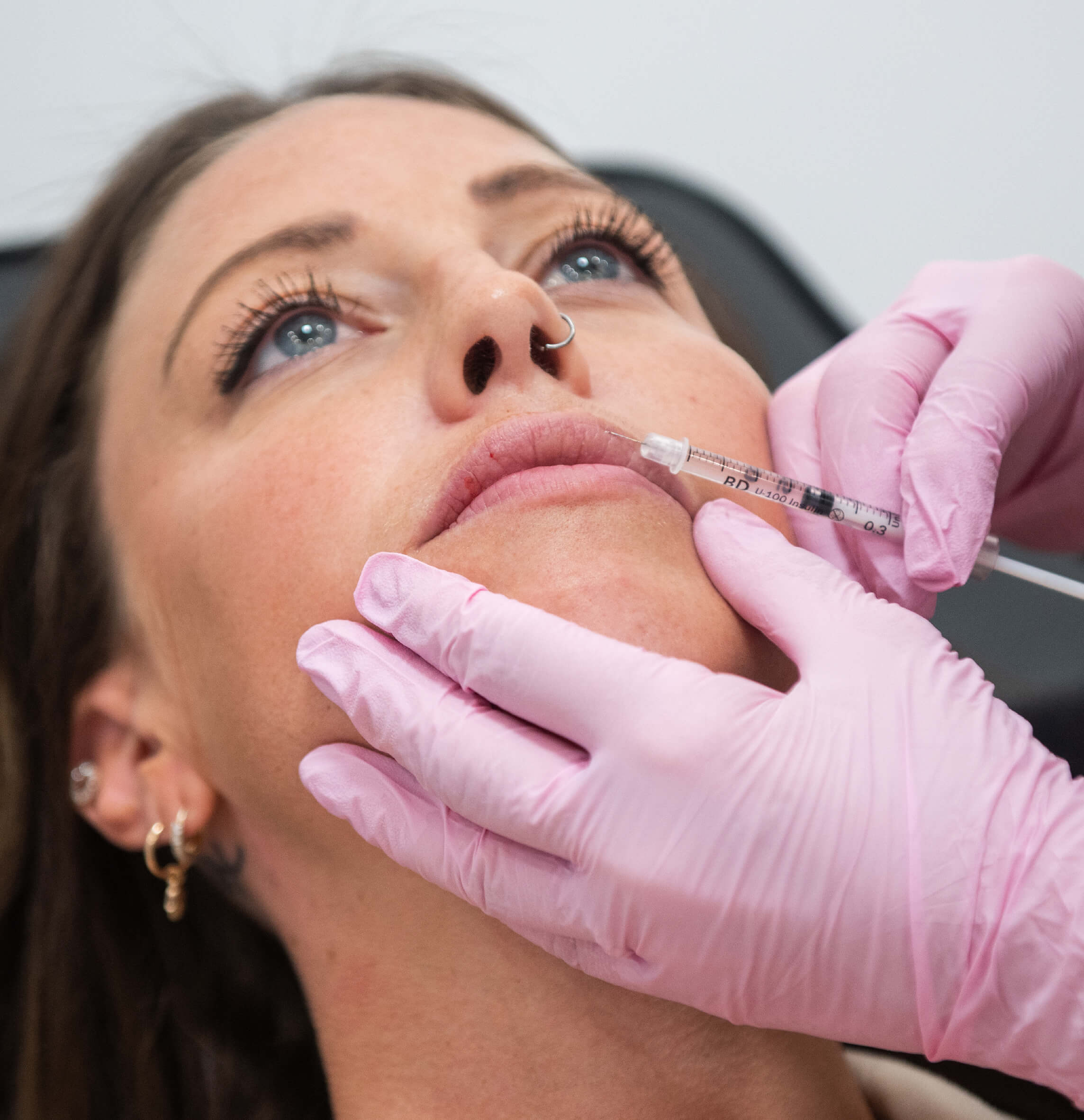 Injection d’acide hyaluronique pour augmentation du volume des lèvres dans un centre médico-esthétique. Patiente allongée, professionnel portant des gants roses applique le traitement esthétique de comblement des rides et des lèvres avec une seringue, technique précise pour améliorer le volume et l’apparence naturelle des lèvres.