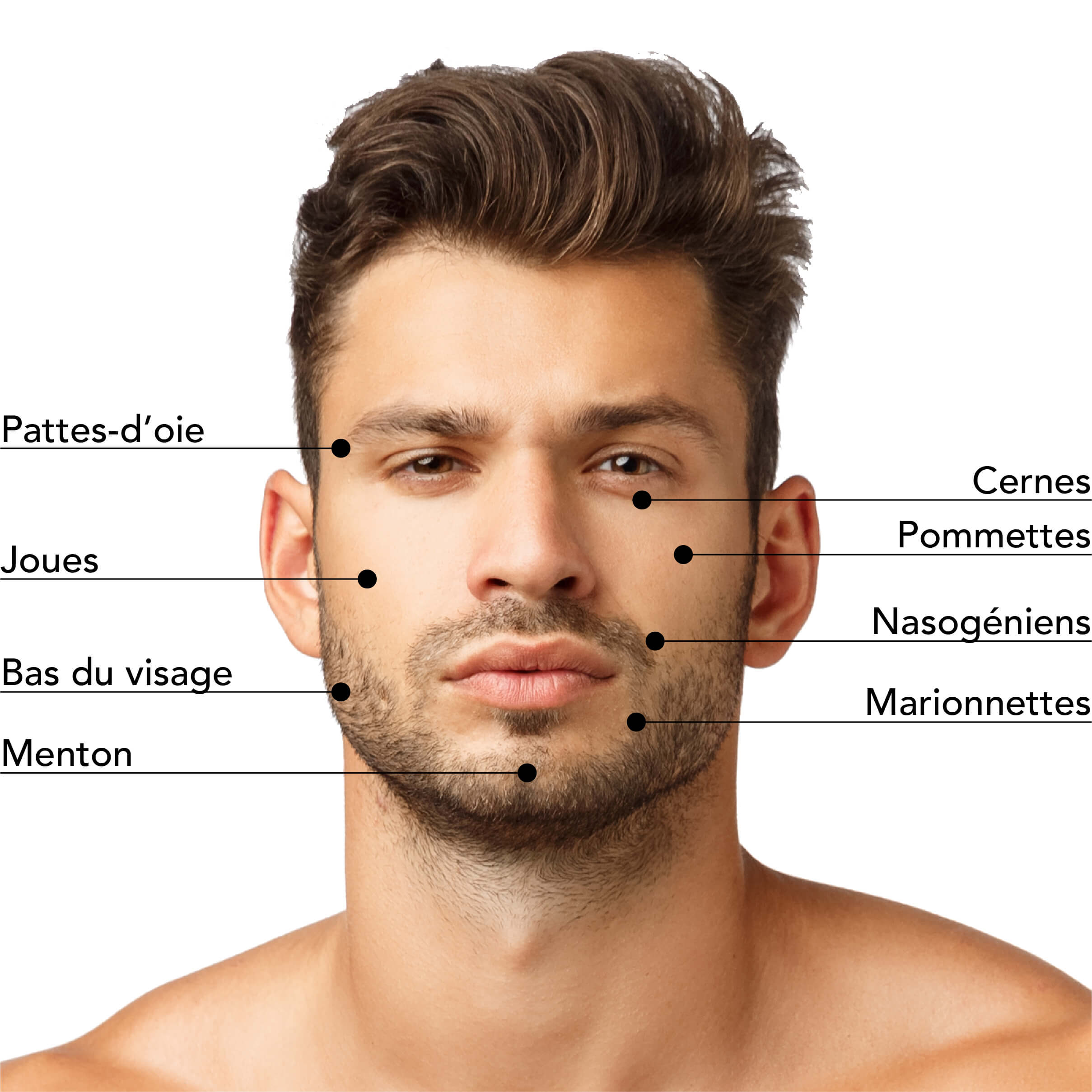 Zones traitables par injection d’acide hyaluronique chez l’homme : joues, bas du visage, menton, cernes, plis nasogéniens et lignes de marionnettes pour un rajeunissement et une correction des volumes du visage.